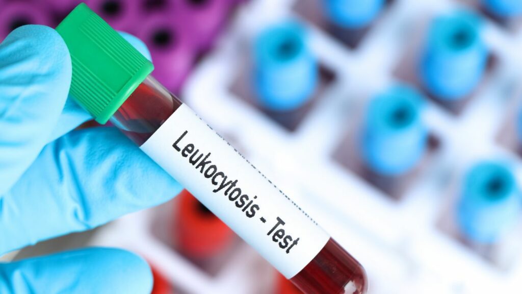 Leucocite Crescute test